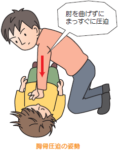 胸骨圧迫の姿勢イラスト