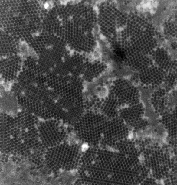 移植腎ポリオーマウイルス腎症のウイルス粒子×40,000