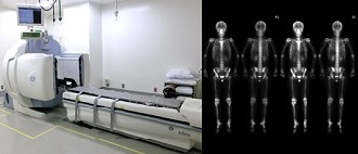 核医学(RI)検査装置 SPECT-CTガンマカメラ